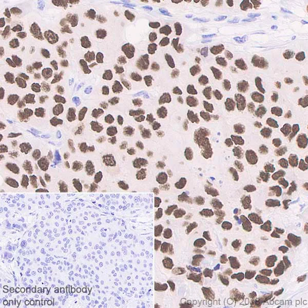 Immunohistochemistry (Formalin/PFA-fixed paraffin-embedded sections) - Anti-FOXA1 + FOXA2 + FOXA3 antibody [EPR10881] (AB170933)
