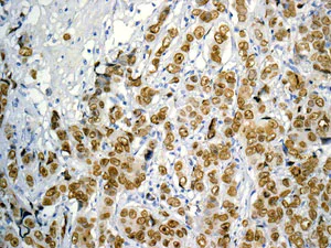 Immunohistochemistry (Formalin/PFA-fixed paraffin-embedded sections) - Anti-FOXA1 + FOXA2 + FOXA3 antibody [EPR10881] (AB170933)