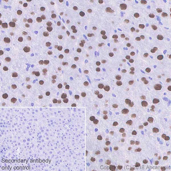 Immunohistochemistry (Formalin/PFA-fixed paraffin-embedded sections) - Anti-FOXA1 + FOXA2 + FOXA3 antibody [EPR10881] (AB170933)