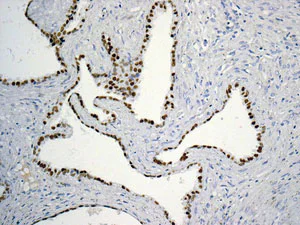 Immunohistochemistry (Formalin/PFA-fixed paraffin-embedded sections) - Anti-FOXA1 + FOXA2 + FOXA3 antibody [EPR10881] (AB170933)
