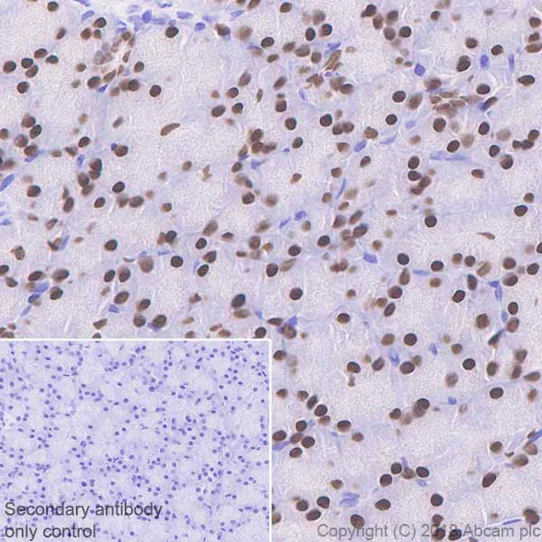 Immunohistochemistry (Formalin/PFA-fixed paraffin-embedded sections) - Anti-FOXA1 + FOXA2 + FOXA3 antibody [EPR10881] (AB170933)
