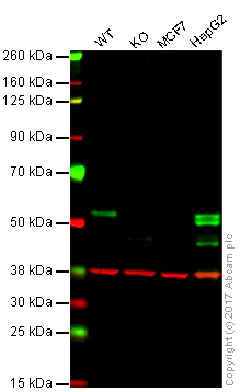 Western blot - Anti-FOXA1 + FOXA2 + FOXA3 antibody [EPR10881] (AB170933)