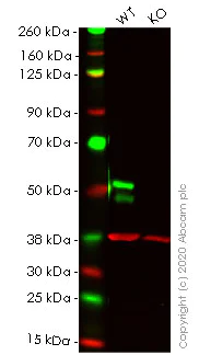 Western blot - Anti-FOXA1 + FOXA2 + FOXA3 antibody [EPR10881] - BSA and Azide free (AB236011)