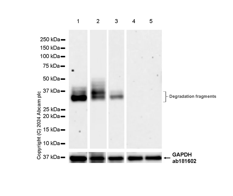 Western blot - Anti-FOXA1 + FOXA2 + FOXA3 antibody [RM1119] (AB317046)