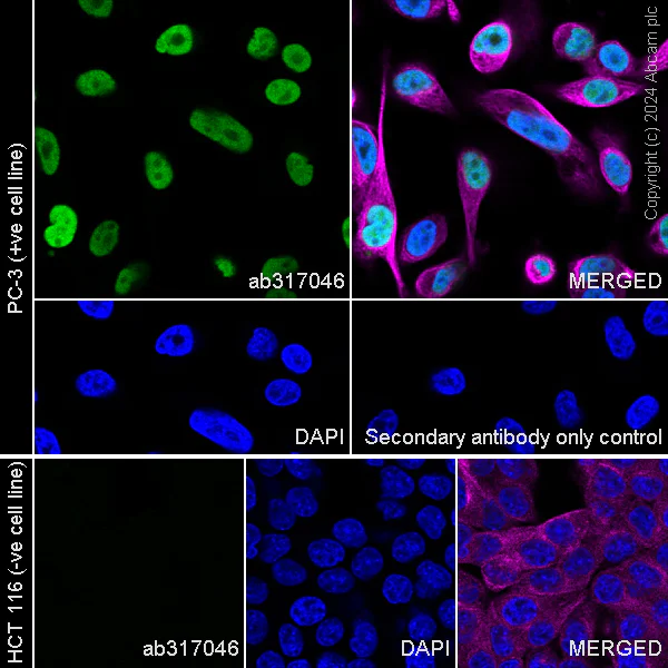 Immunocytochemistry/ Immunofluorescence - Anti-FOXA1 + FOXA2 + FOXA3 antibody [RM1119] - BSA and Azide free (AB317047)