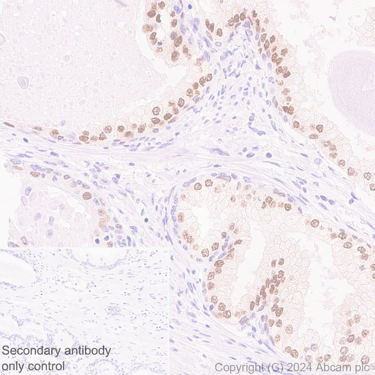 Immunohistochemistry (Formalin/PFA-fixed paraffin-embedded sections) - Anti-FOXA1 + FOXA2 + FOXA3 antibody [RM1119] - BSA and Azide free (AB317047)
