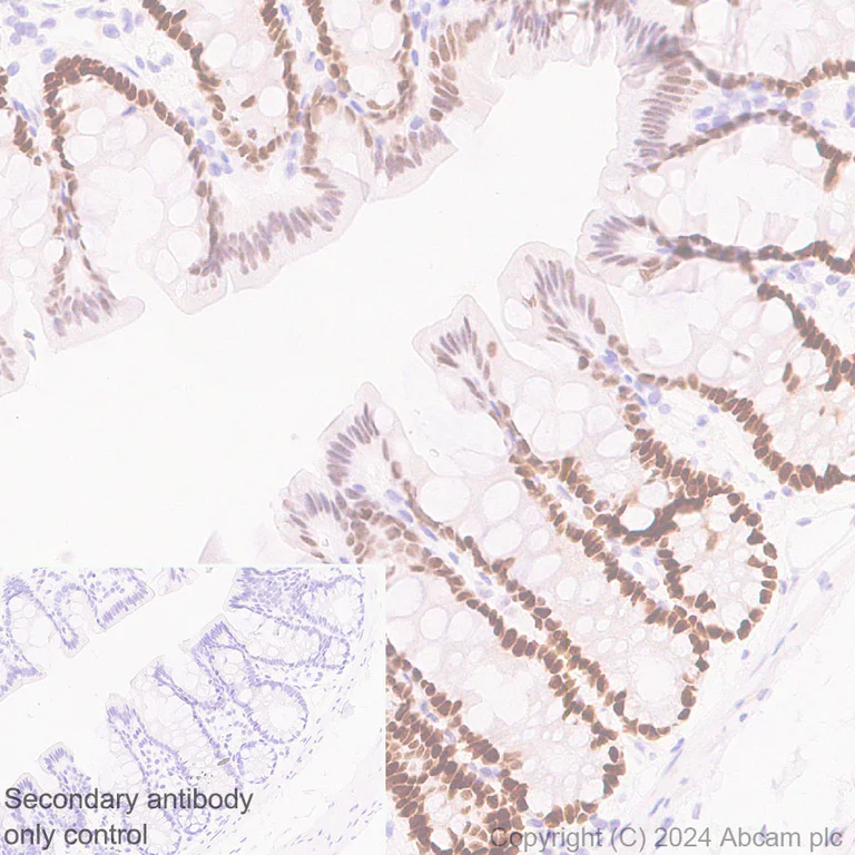 Immunohistochemistry (Formalin/PFA-fixed paraffin-embedded sections) - Anti-FOXA1 + FOXA2 + FOXA3 antibody [RM1119] - BSA and Azide free (AB317047)