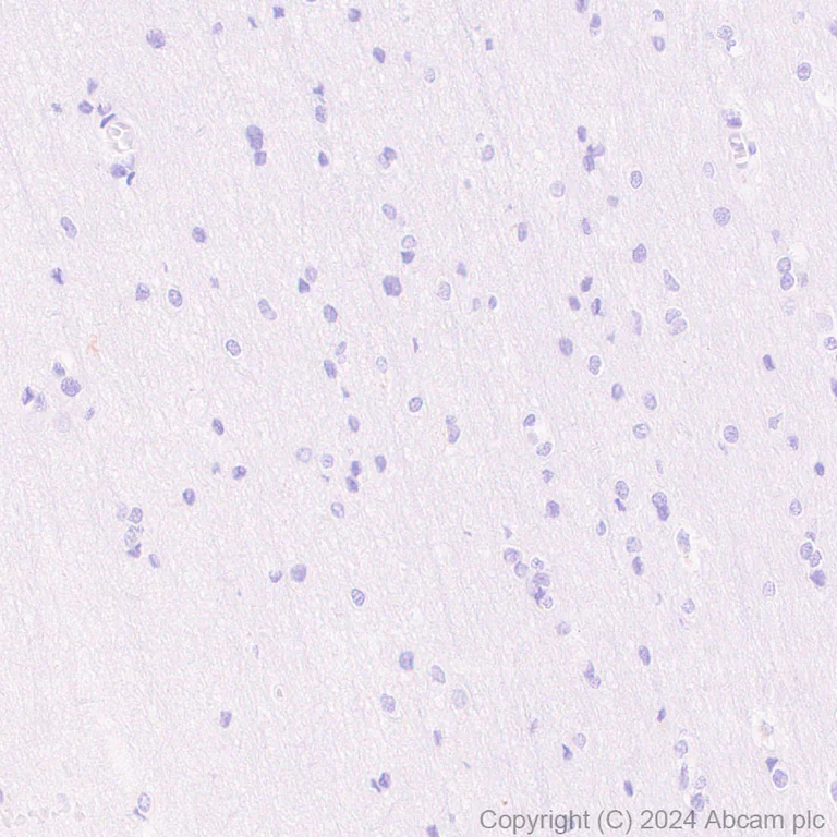 Immunohistochemistry (Formalin/PFA-fixed paraffin-embedded sections) - Anti-FOXA1 + FOXA2 + FOXA3 antibody [RM1119] - BSA and Azide free (AB317047)