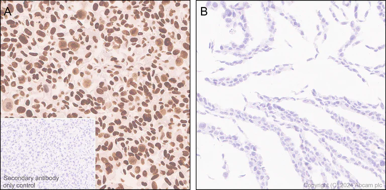 Immunohistochemistry (Formalin/PFA-fixed paraffin-embedded sections) - Anti-FOXA1 + FOXA2 + FOXA3 antibody [RM1119] - BSA and Azide free (AB317047)