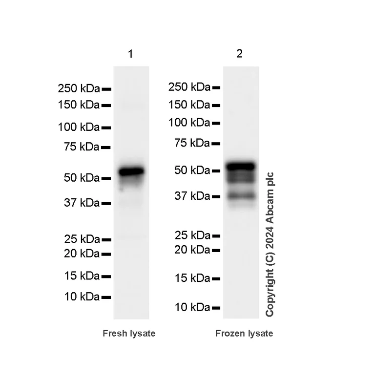 Western blot - Anti-FOXA1 + FOXA2 + FOXA3 antibody [RM1119] - BSA and Azide free (AB317047)