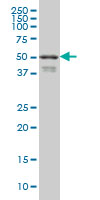 Western blot - Anti-FOXA2 antibody [7E6] - BSA and Azide free (AB60721), expandable thumbnail