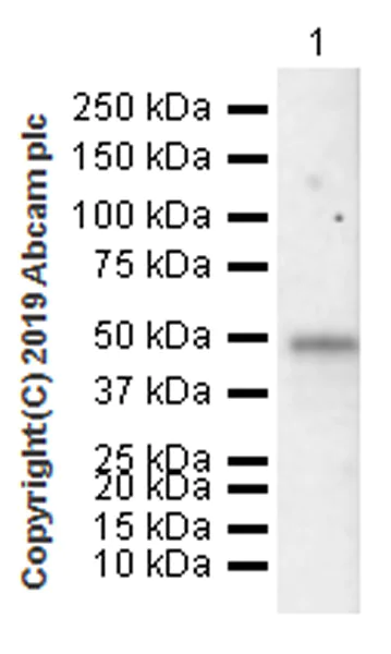 Western blot - Anti-FOXA2 antibody [EPR22919-71] - ChIP Grade (AB256493)