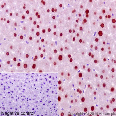 Immunohistochemistry (Formalin/PFA-fixed paraffin-embedded sections) - Anti-FOXA2 antibody [EPR4466] (AB108422), expandable thumbnail