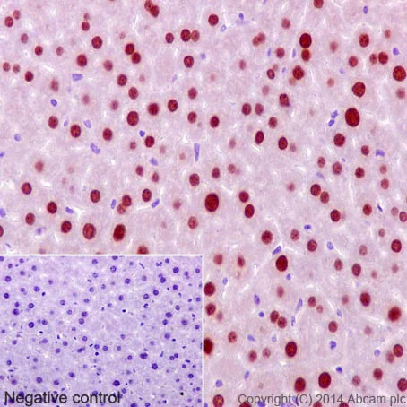 Immunohistochemistry (Formalin/PFA-fixed paraffin-embedded sections) - Anti-FOXA2 antibody [EPR4466] (AB108422)