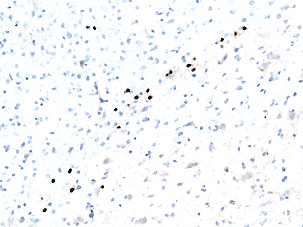 Immunohistochemistry (Formalin/PFA-fixed paraffin-embedded sections) - Anti-FOXA2 antibody [EPR4466] (ab108422), expandable thumbnail