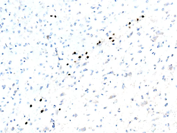 Immunohistochemistry (Formalin/PFA-fixed paraffin-embedded sections) - Anti-FOXA2 antibody [EPR4466] (AB108422)