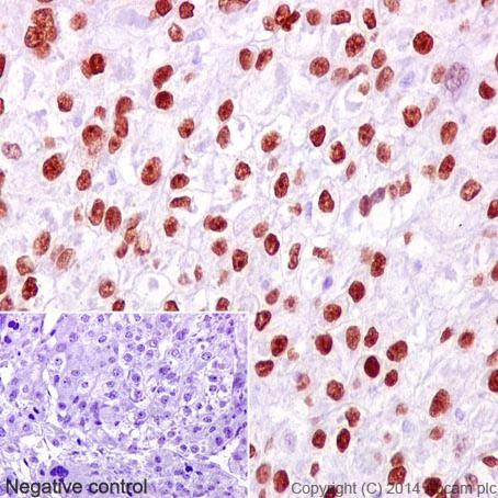 Immunohistochemistry (Formalin/PFA-fixed paraffin-embedded sections) - Anti-FOXA2 antibody [EPR4466] (AB108422), expandable thumbnail