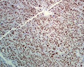 Immunohistochemistry (Formalin/PFA-fixed paraffin-embedded sections) - Anti-FOXA2 antibody [EPR4466] (ab108422), expandable thumbnail