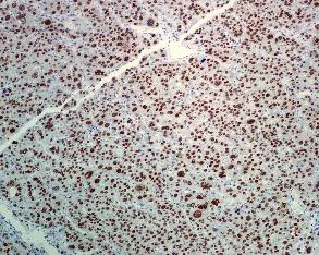 Immunohistochemistry (Formalin/PFA-fixed paraffin-embedded sections) - Anti-FOXA2 antibody [EPR4466] (AB108422)