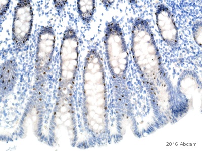 Immunohistochemistry (Formalin/PFA-fixed paraffin-embedded sections) - Anti-FOXA2 antibody [EPR4466] (ab108422), expandable thumbnail