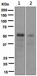 Western blot - Anti-FOXA2 antibody [EPR4466] (AB108422), expandable thumbnail