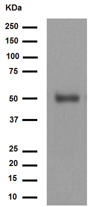 Western blot - Anti-FOXA2 antibody [EPR4466] (AB108422), expandable thumbnail