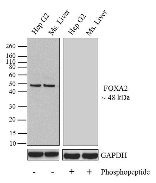 Western blot - Anti-FOXA2 (phospho T156) Antibody [RP23040101] (AB313412)