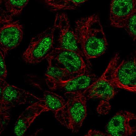 Immunocytochemistry/ Immunofluorescence - Anti-FOXA3 antibody (AB222245), expandable thumbnail