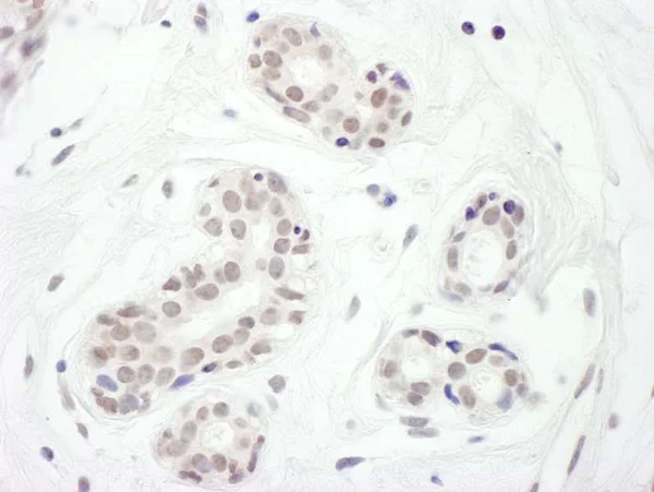 Immunohistochemistry (Formalin/PFA-fixed paraffin-embedded sections) - Anti-FOXC1 antibody (AB226219)