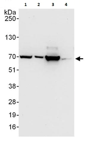 Western blot - Anti-FOXC1 antibody (AB226219)