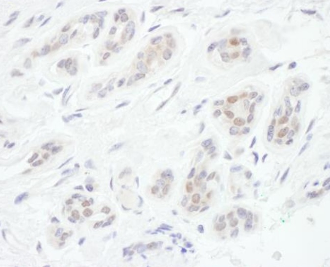 Immunohistochemistry (Formalin/PFA-fixed paraffin-embedded sections) - Anti-FOXC1 antibody (AB245443)