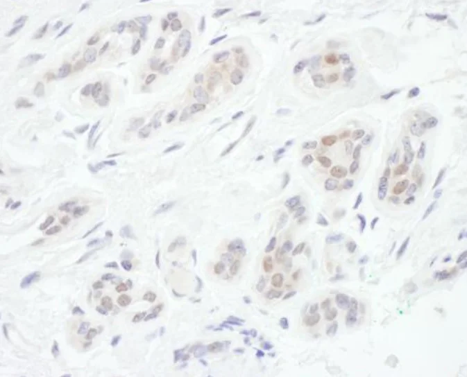Immunohistochemistry (Formalin/PFA-fixed paraffin-embedded sections) - Anti-FOXC1 antibody (AB245443)