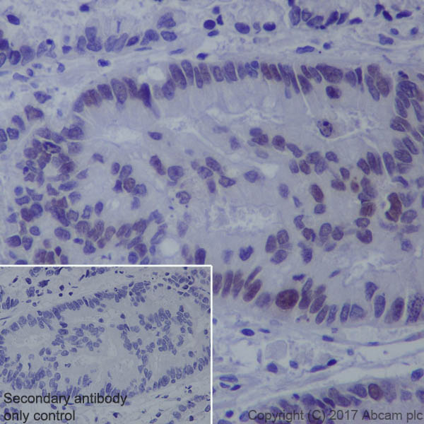 Immunohistochemistry (Formalin/PFA-fixed paraffin-embedded sections) - Anti-FOXC1 antibody [EPR20678] - BSA and Azide free (AB230157)