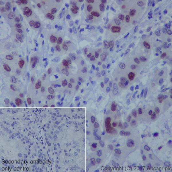 Immunohistochemistry (Formalin/PFA-fixed paraffin-embedded sections) - Anti-FOXC1 antibody [EPR20678] - BSA and Azide free (AB230157)