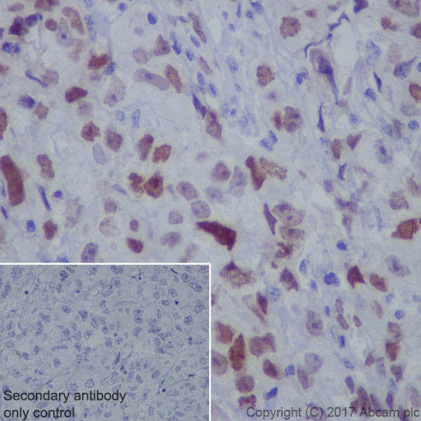 Immunohistochemistry (Formalin/PFA-fixed paraffin-embedded sections) - Anti-FOXC1 antibody [EPR20678] - BSA and Azide free (AB230157)