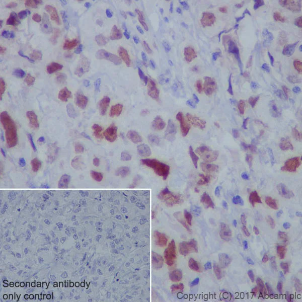 Immunohistochemistry (Formalin/PFA-fixed paraffin-embedded sections) - Anti-FOXC1 antibody [EPR20678] - BSA and Azide free (AB230157)