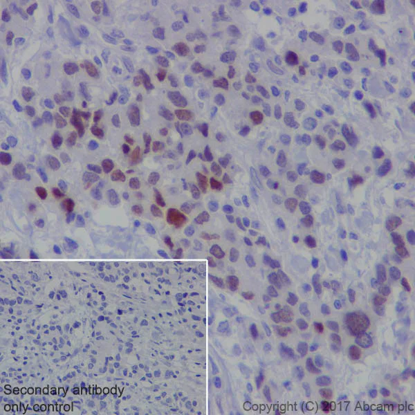 Immunohistochemistry (Formalin/PFA-fixed paraffin-embedded sections) - Anti-FOXC1 antibody [EPR20685] (AB227977)