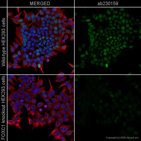 Immunocytochemistry/ Immunofluorescence - Anti-FOXC1 antibody [EPR20685] - BSA and Azide free (AB230159)