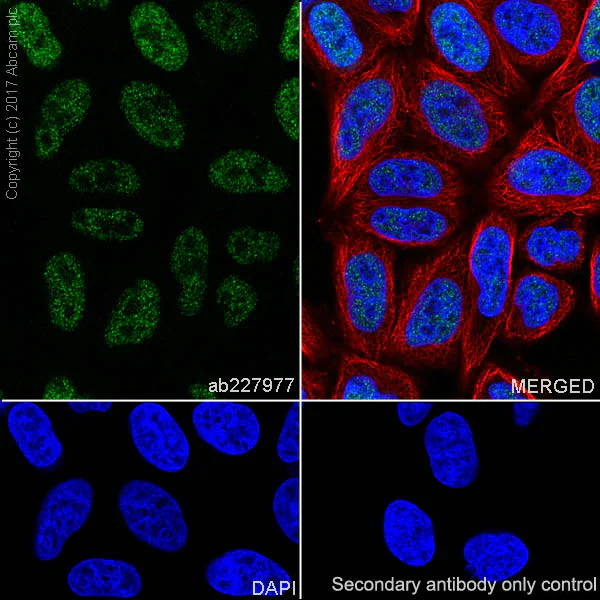 Immunocytochemistry/ Immunofluorescence - Anti-FOXC1 antibody [EPR20685] - BSA and Azide free (AB230159)