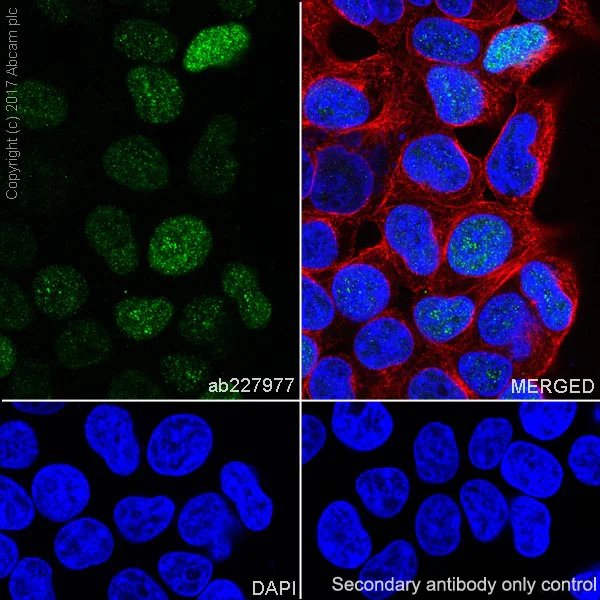 Immunocytochemistry/ Immunofluorescence - Anti-FOXC1 antibody [EPR20685] - BSA and Azide free (AB230159)