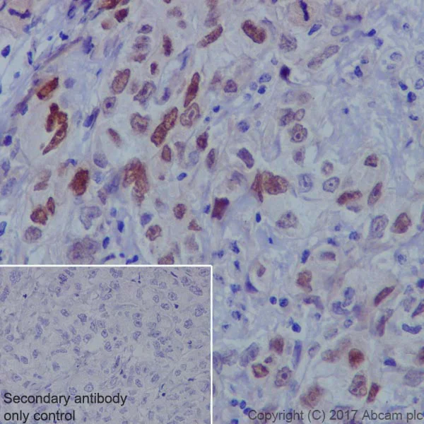 Immunohistochemistry (Formalin/PFA-fixed paraffin-embedded sections) - Anti-FOXC1 antibody [EPR20685] - BSA and Azide free (AB230159)