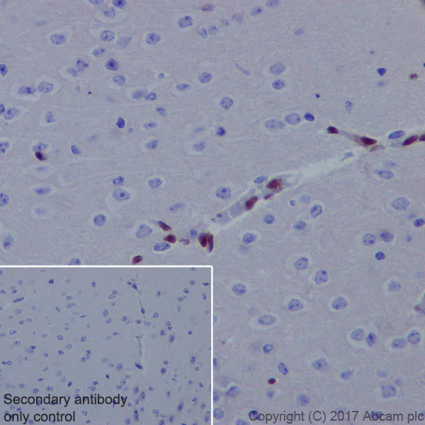 Immunohistochemistry (Formalin/PFA-fixed paraffin-embedded sections) - Anti-FOXC1 antibody [EPR20685] - BSA and Azide free (AB230159)