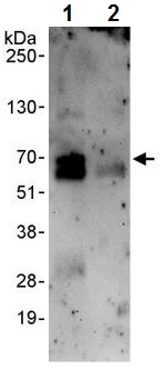 Immunoprecipitation - Anti-FOXC2 antibody (AB245510)