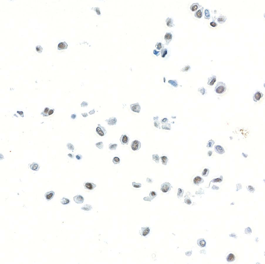 Immunocytochemistry - Anti-FOXC2 antibody [BLR184J] - BSA free (ab314051), expandable thumbnail