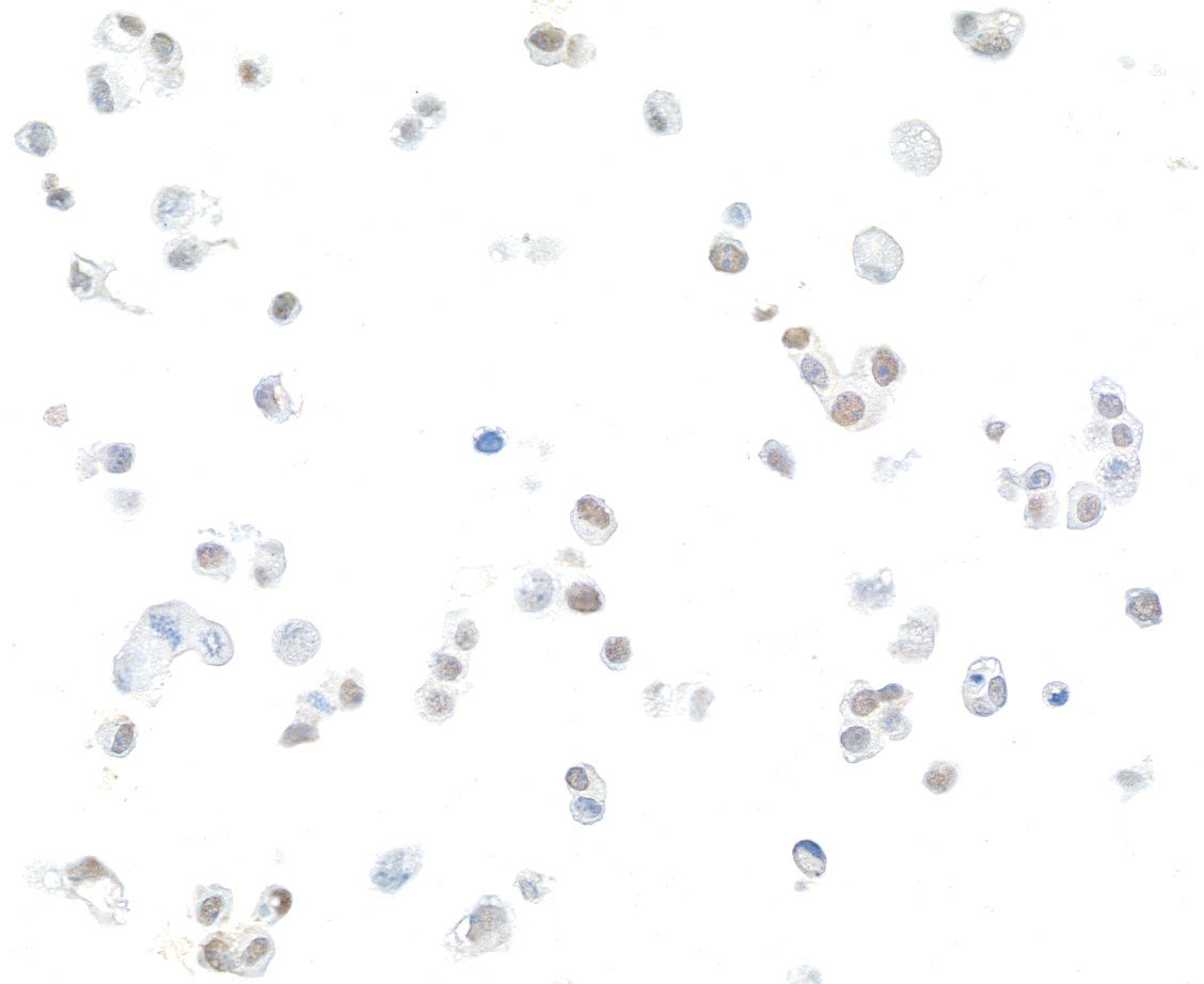 Immunocytochemistry - Anti-FOXC2 antibody [BLR184J] - BSA free (AB314051), expandable thumbnail