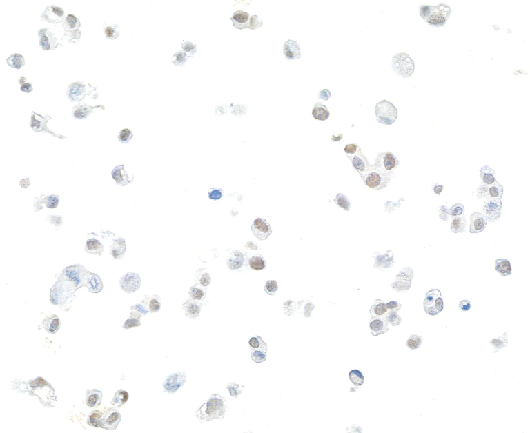 Immunocytochemistry - Anti-FOXC2 antibody [BLR184J] - BSA free (AB314051)