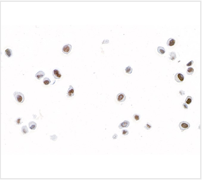 Immunocytochemistry - Anti-FOXC2 antibody [BLR184J] - BSA free (AB314051), expandable thumbnail