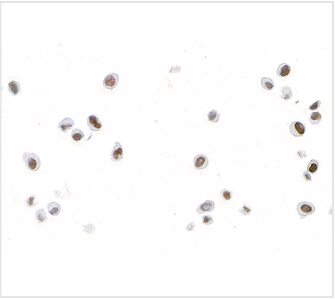 Immunocytochemistry - Anti-FOXC2 antibody [BLR184J] - BSA free (AB314051)