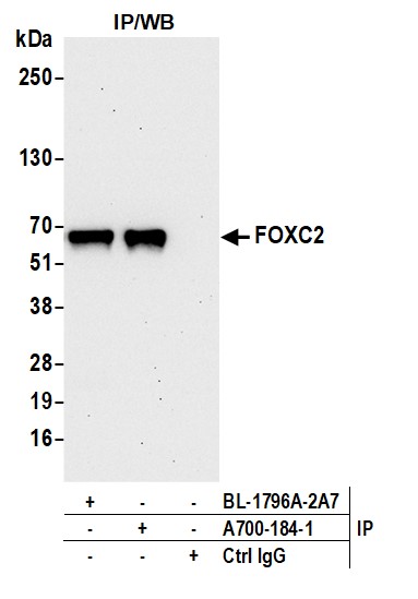 Immunoprecipitation - Anti-FOXC2 antibody [BLR184J] - BSA free (AB314051), expandable thumbnail