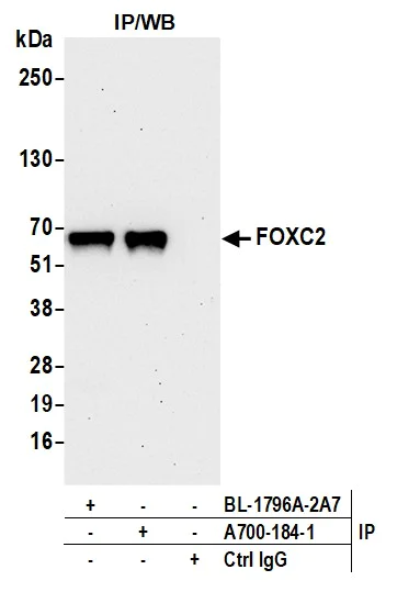 Immunoprecipitation - Anti-FOXC2 antibody [BLR184J] - BSA free (AB314051)